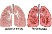 причинява кашлица