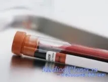 МІОМА МАТКИ - ОПЕРАТИВНЕ ЛІКУВАННЯ оперативне