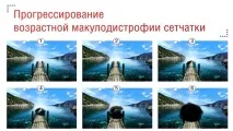 Макулодистрофія сітківки очі лікування макулодистрофія