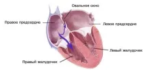 сърцето овален