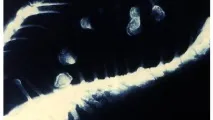 тумори хрущялната