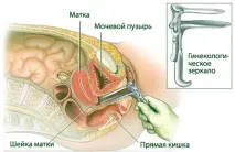 Перший раз у гінеколога як підготуватися до огляду огляду