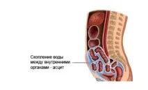 лечение лечение