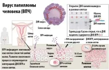 брадавици жени