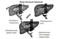 причини симптоми