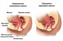 време време