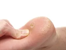 методи причини