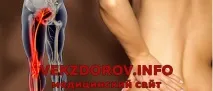 признаци притискане
