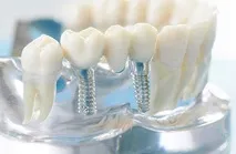 denta-prestige