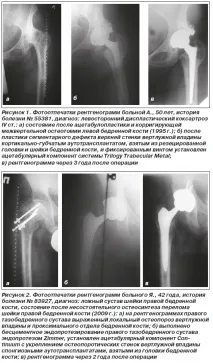 приложение клинично