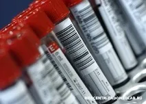 Здати аналіз крові на ПСА (простатичний специфічний антиген) на Дмитрівській, Менделєєвській, специфічний