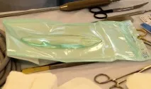 пищяла круропластика
