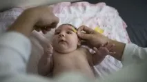 Мікроцефалія - причини, симптоми, ознаки та лікування симптоми