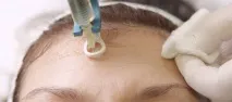мезотерапія
