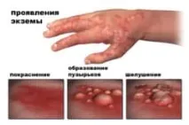 Тавегіл та алкоголь сумісність та наслідки сумісність