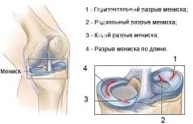 Травми у баскетболі може