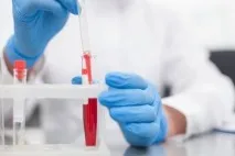 Тромбоцити вище норми причини, симптоми та небезпечні ознаки вище