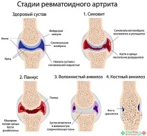 колянната колянната