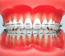Сред недостатъците инсталиране