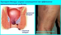 venarus хемороиди