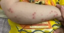 превенция превенция