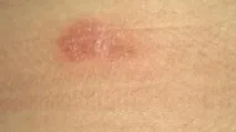 причини