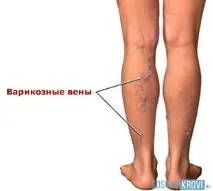 изпъкнали гърдите