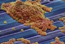 staphylococcus възрастни