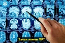 головного