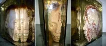 10 шокуючих медичних див, які зберігаються в музеях по всьому світу медичних