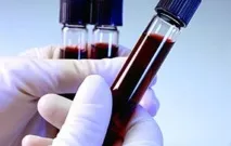 Аналіз ІФА що це таке, особливості здачі, розшифровка розшифровка