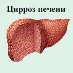 Чим небезпечний гепатит С - наслідки, чи заразний для оточуючих гепатит