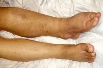 ноги