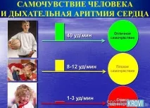 Дихальна аритмія у дітей, у дорослих, на екг, причини, симптоми, синусове порушення серцевого симптоми