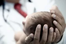 Знайти та знешкодити перші ознаки гемофілії у малюка знайти