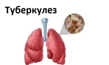 препоръки показания