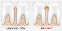 корекцията възниква