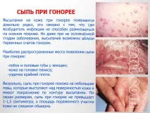 характерни снимки