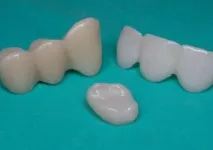 зъбни коронки корони