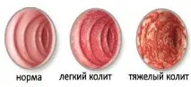 живота живота