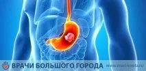 стомаха