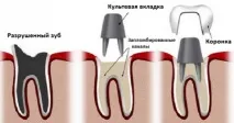 възстановяване развален