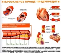 лечение съдова