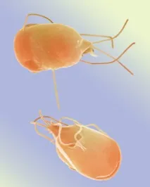 giardia черния