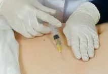 Мезотерапія для схуднення ефект від процедури та ціни схуднення