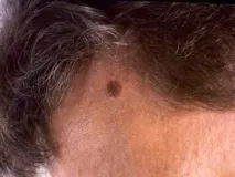 локализация локализация