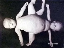 Музей медичної історії Мюттера (40 фото) - Приколи на - купа фото, відео, флеш приколів, історії