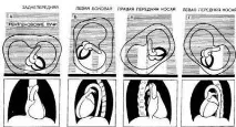 Нормальна конфігурація серця нормальна