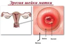 Не вірте гінекологу 10 діагнозів-обманів з метою витягти з вас гроші вірте