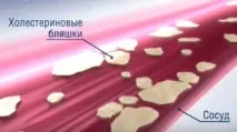 Омега 3 доппельгерц інструкція із застосування та не тільки тільки